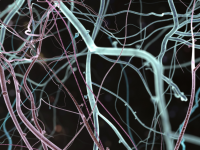 Psicopedagogia com Ênfase em Neuro Educação